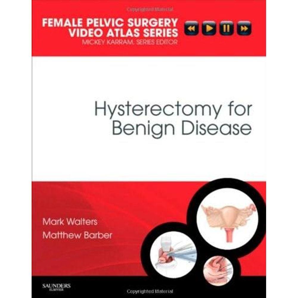 Hysterectomy For Benign Disease