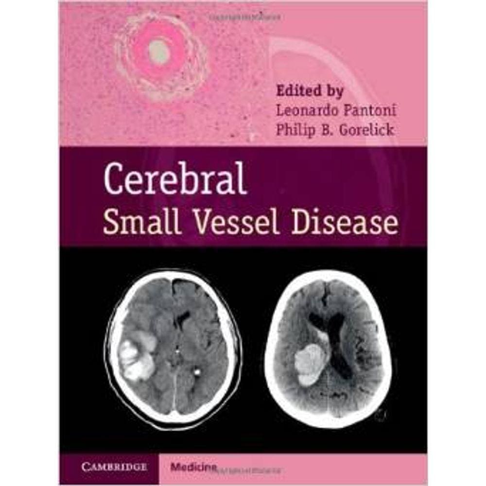 Cerebral Small Vessel Disease