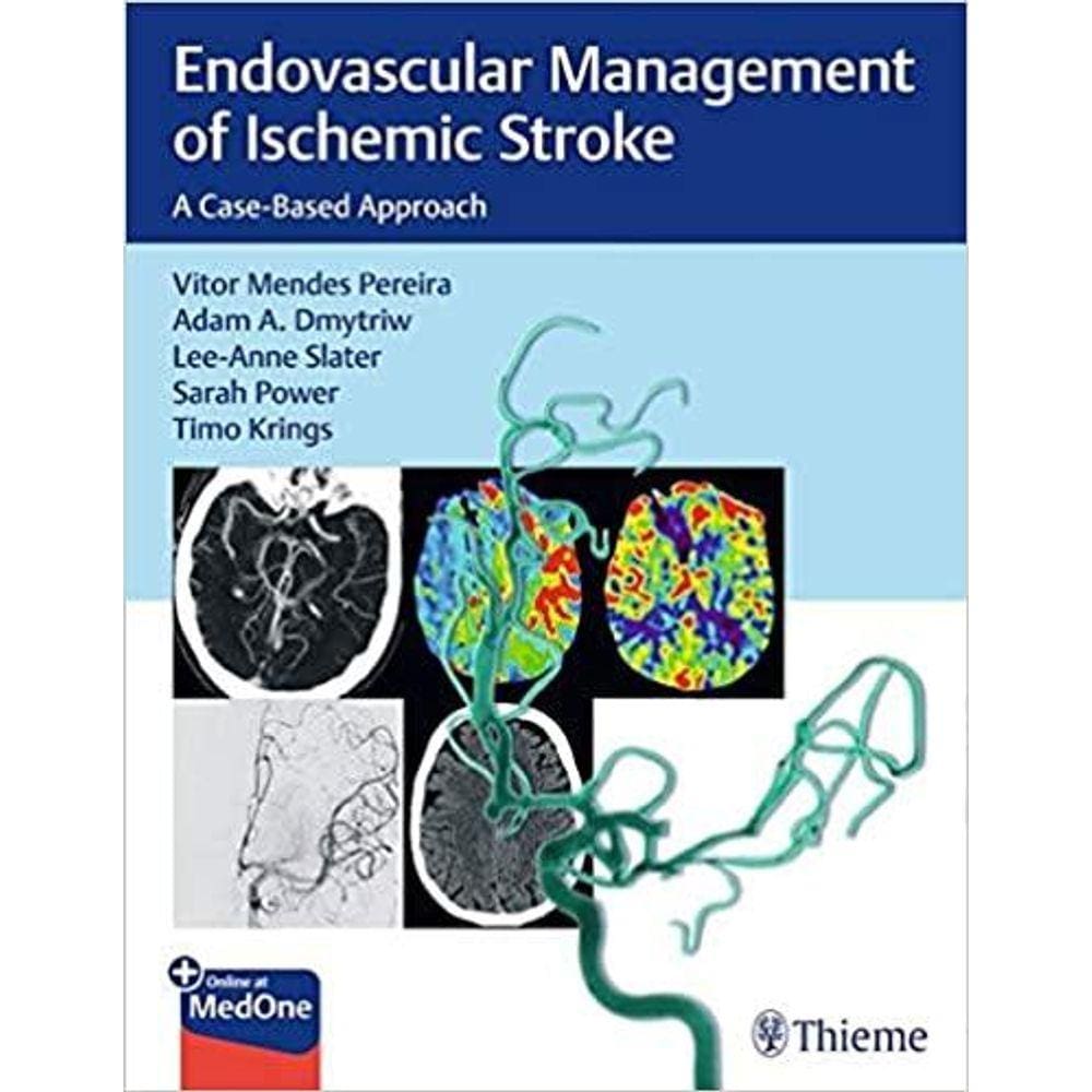 Endovascular Management Of Ischemic Stroke
