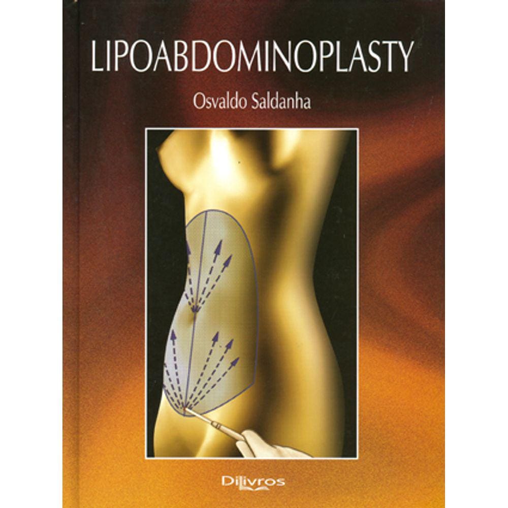 Lipoabdominoplasty