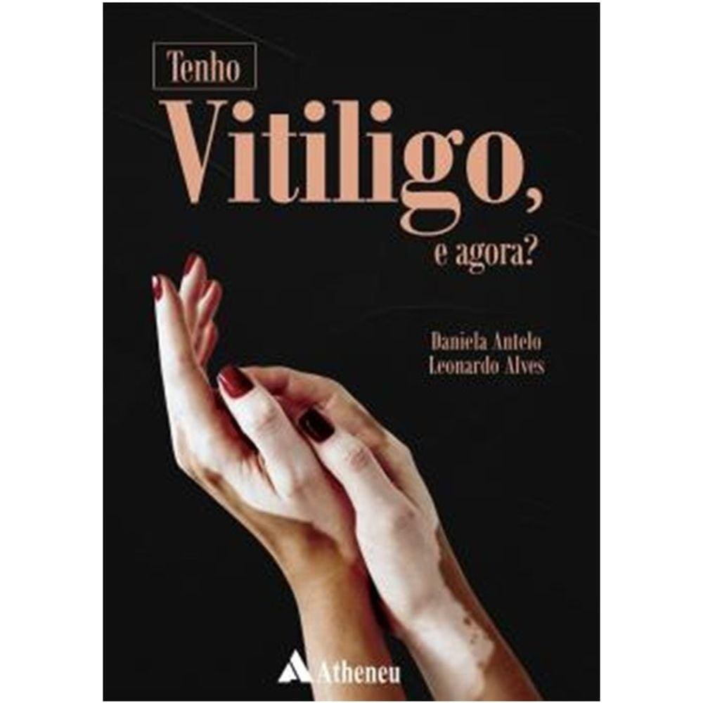 Tenho Vitiligo E Agora