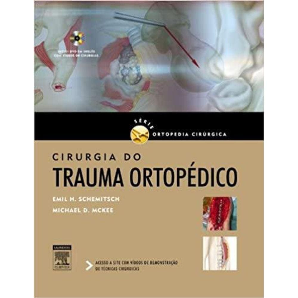 Cirurgia Do Trauma Ortopedico