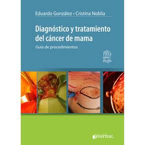 Diagnostico Y Tratamiento Del Cancer De Mama