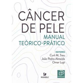 Cancer De Pele
