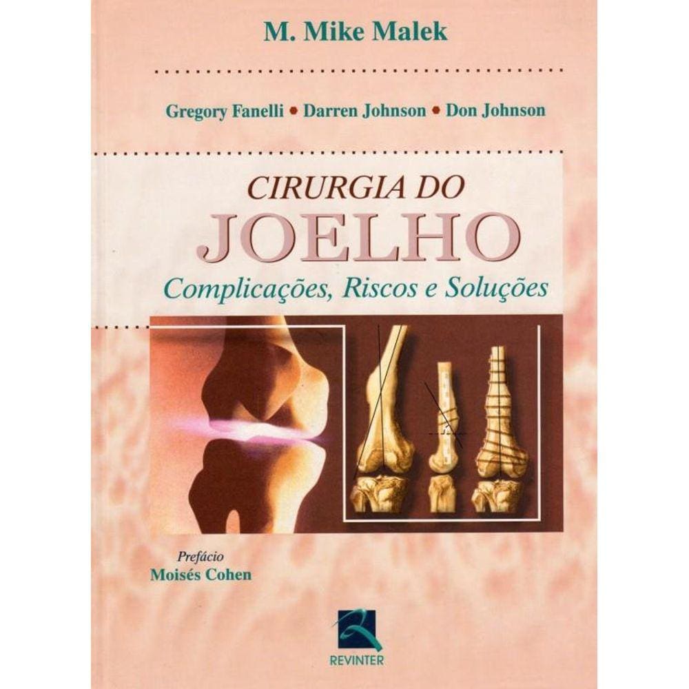 Cirurgia do Joelho