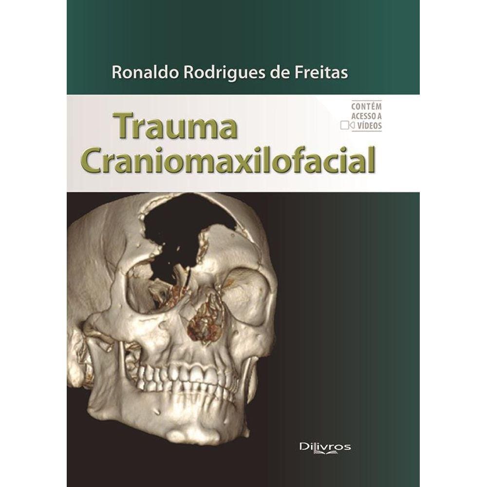 Trauma Craniomaxilofacial