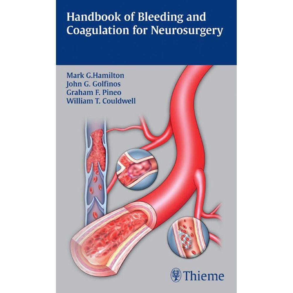 Handbook Of Bleeding And Coagulation For Neurosurgery