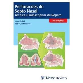 Perfuracoes Do Septo Nasal Tecnicas Endoscopicas De Reparo