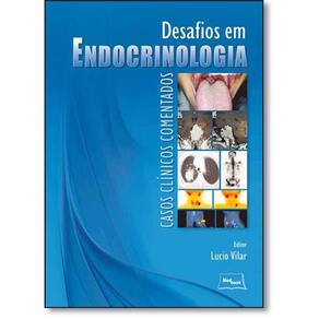 Desafio Em Endocrinologia - Casos Clinicos Comentados