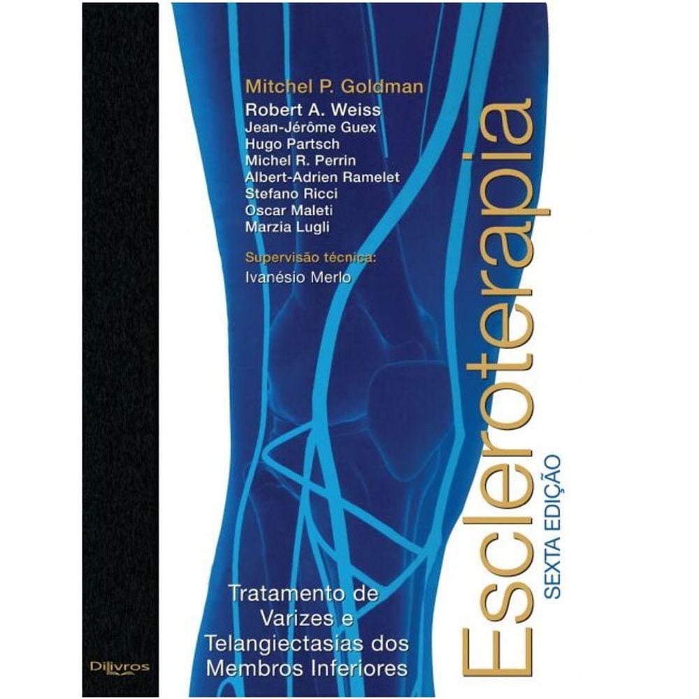 Escleroterapia