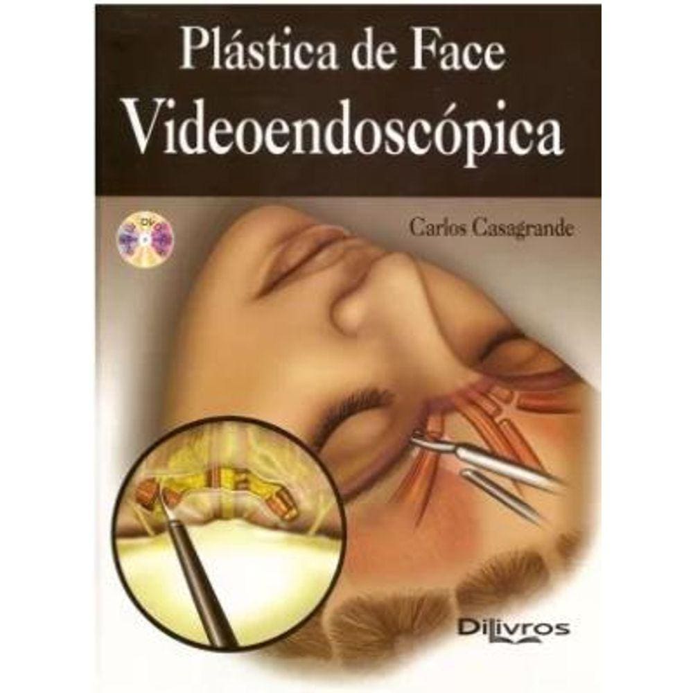 Plastica De Face Videoendoscopica