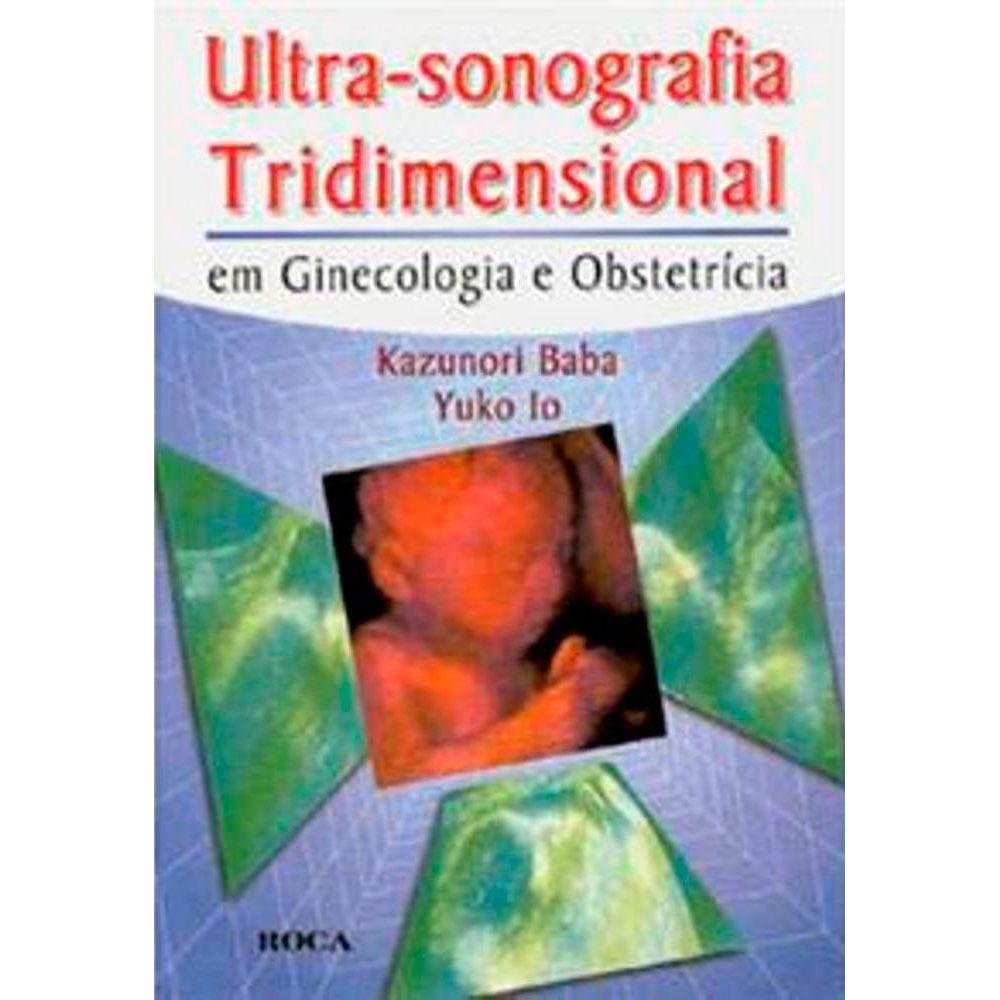 Ultra Sonografia Tridimensional Em Ginecologia E Obstetricia | Casas Bahia