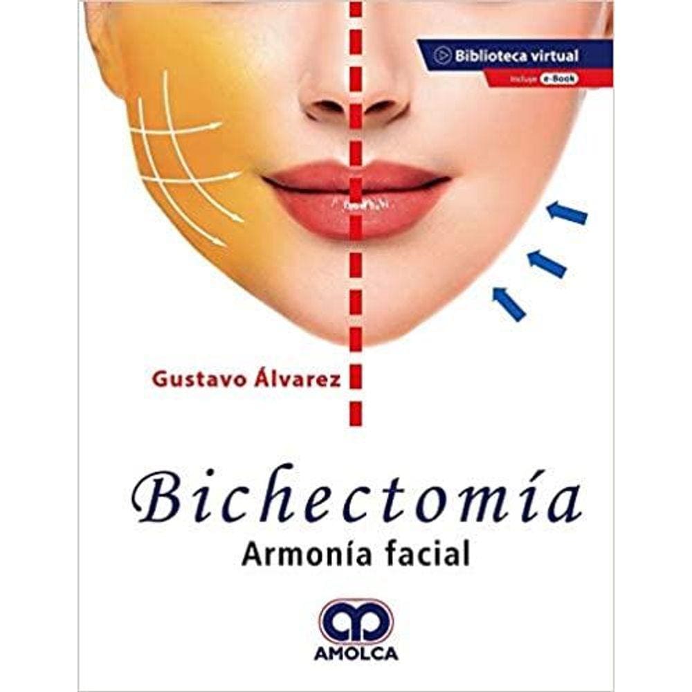 Bichectomia Armonia Facial