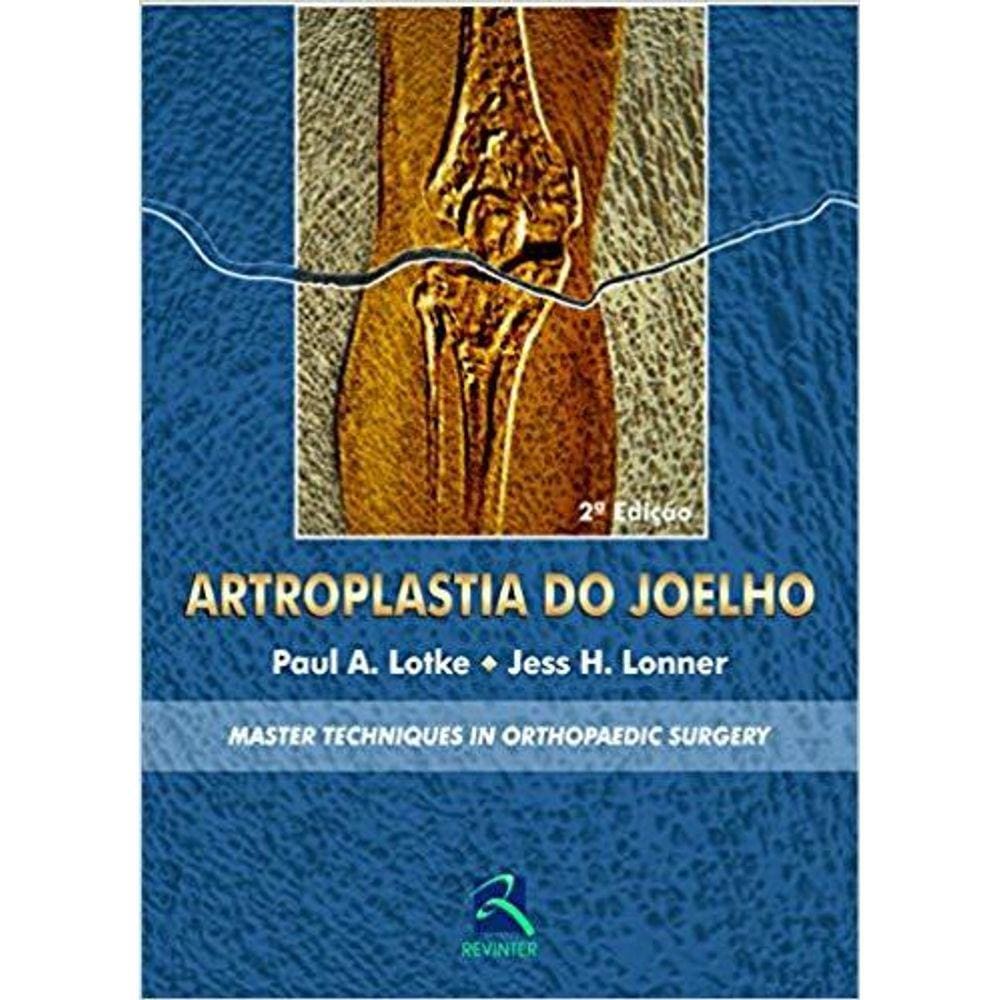 Artroplastia Do Joelho - Master Techniques