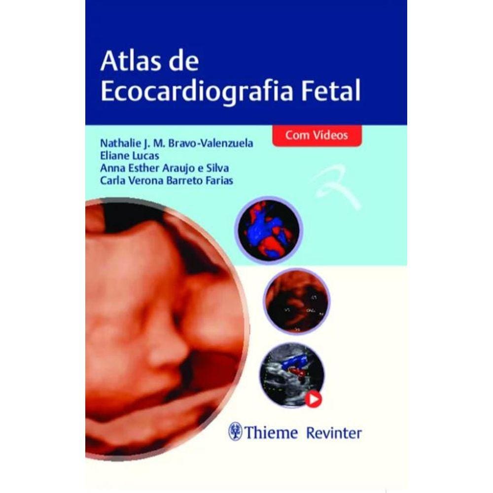 Atlas De Ecocardiografia Fetal