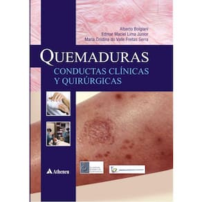 Queimaduras - Conductas Clínicas Y Quirúrgicas