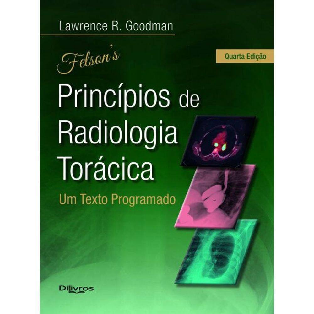 Felson Principios De Radiologia Toracica