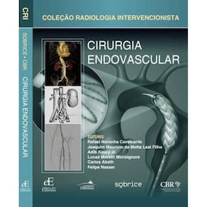 Cirurgia Endovascular Colecao Radiologia Intervencionista