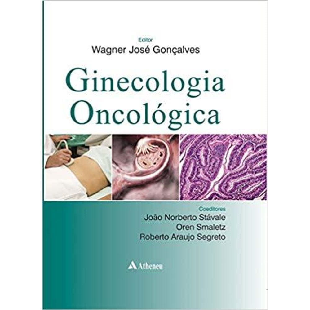 Ginecologia Oncológica