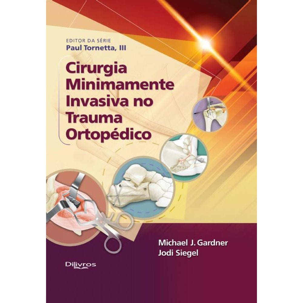 Cirurgia Minimamente Invasiva No Trauma Ortopedico