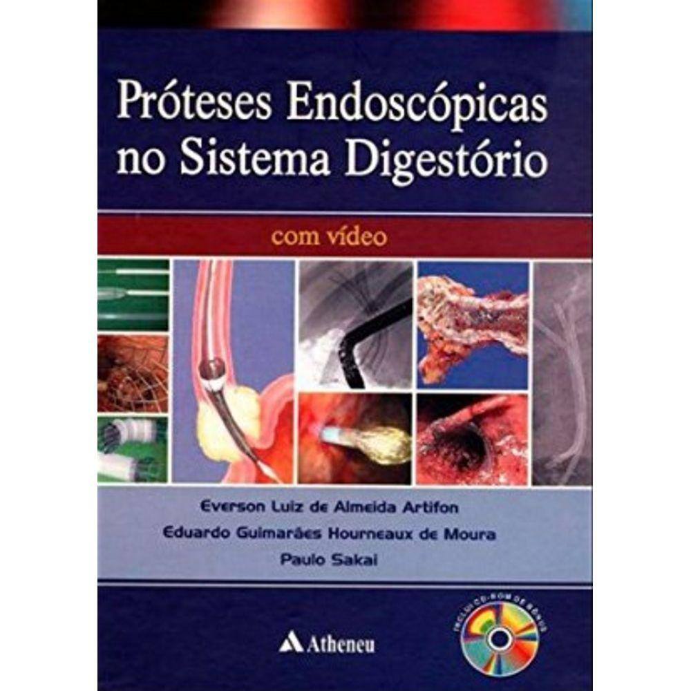 Prótese Endoscópica Do Sistema Digestório