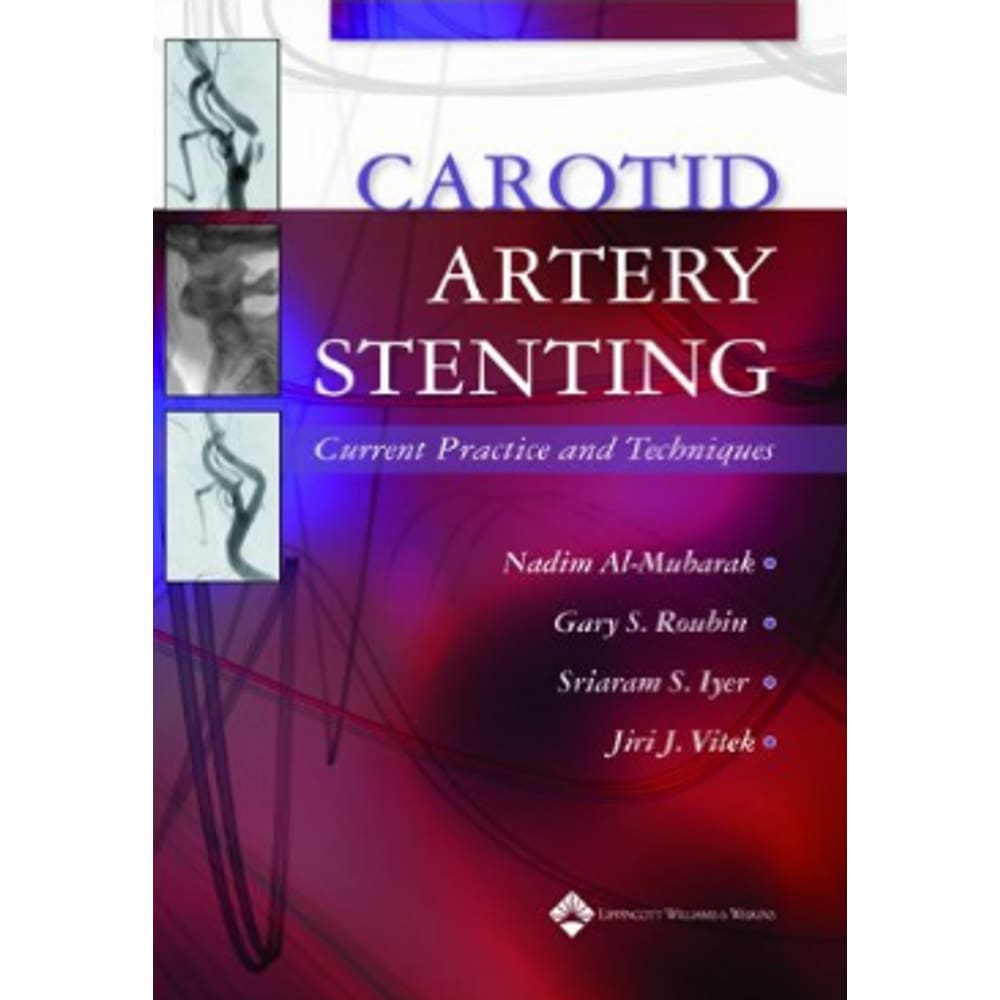 Carotid Artery Stenting: Current Practice And Techniques