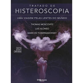 Tratado De Histeroscopia Uma Viagem Pelas Lentes Do Mundo