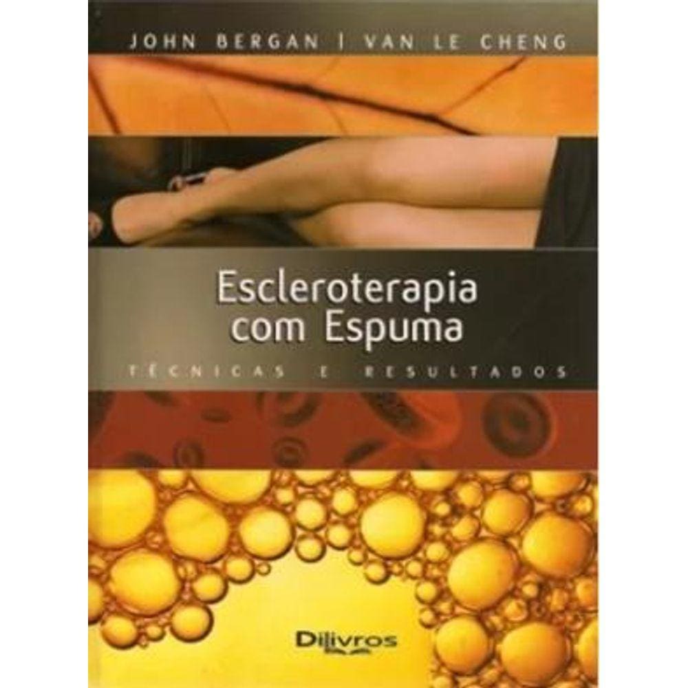 Escleroterapia Com Espuma