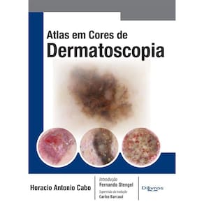 Atlas Em Cores De Dermatoscopia