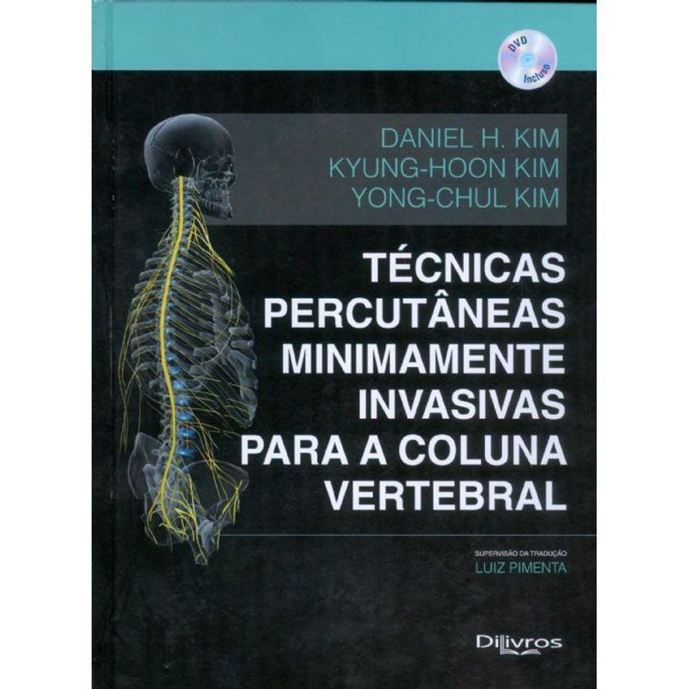 Tecnicas Percutaneas Minimamente Invasivas Para Coluna Vertebral