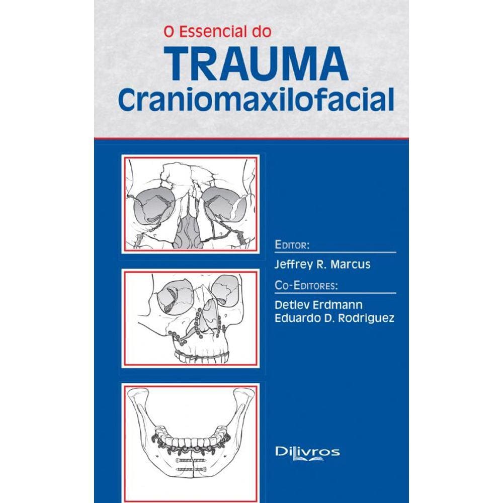 Essencial Do Trauma Craniomaxilofacial, O