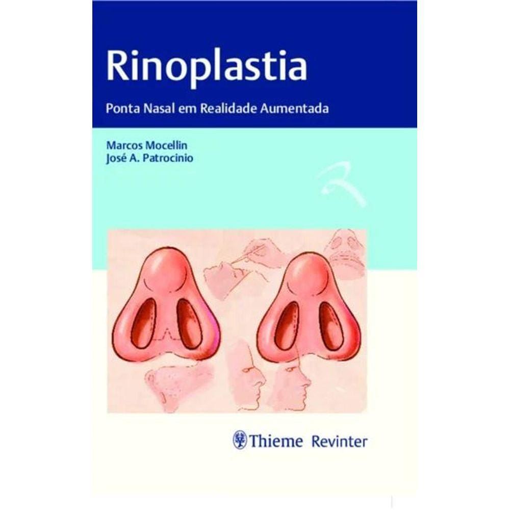 Rinoplastia