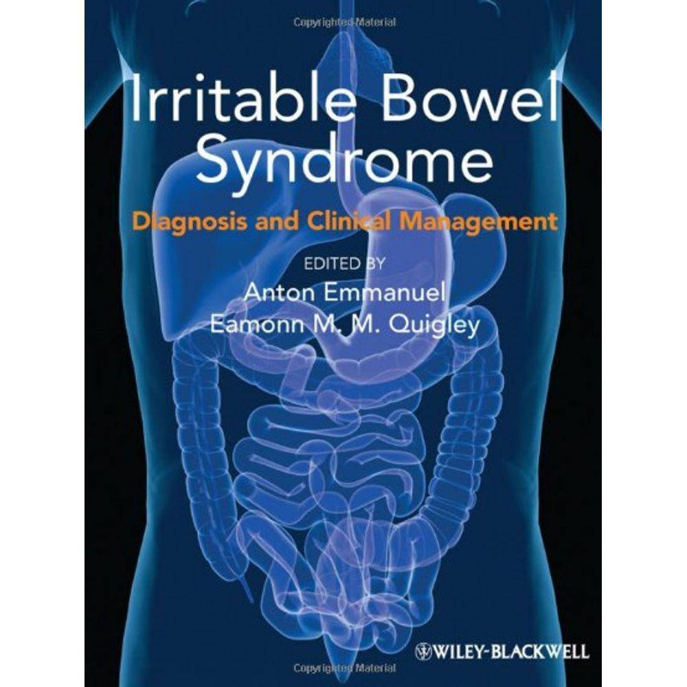 Irritable Bowel Syndrome: Diagnosis And Clinical Management