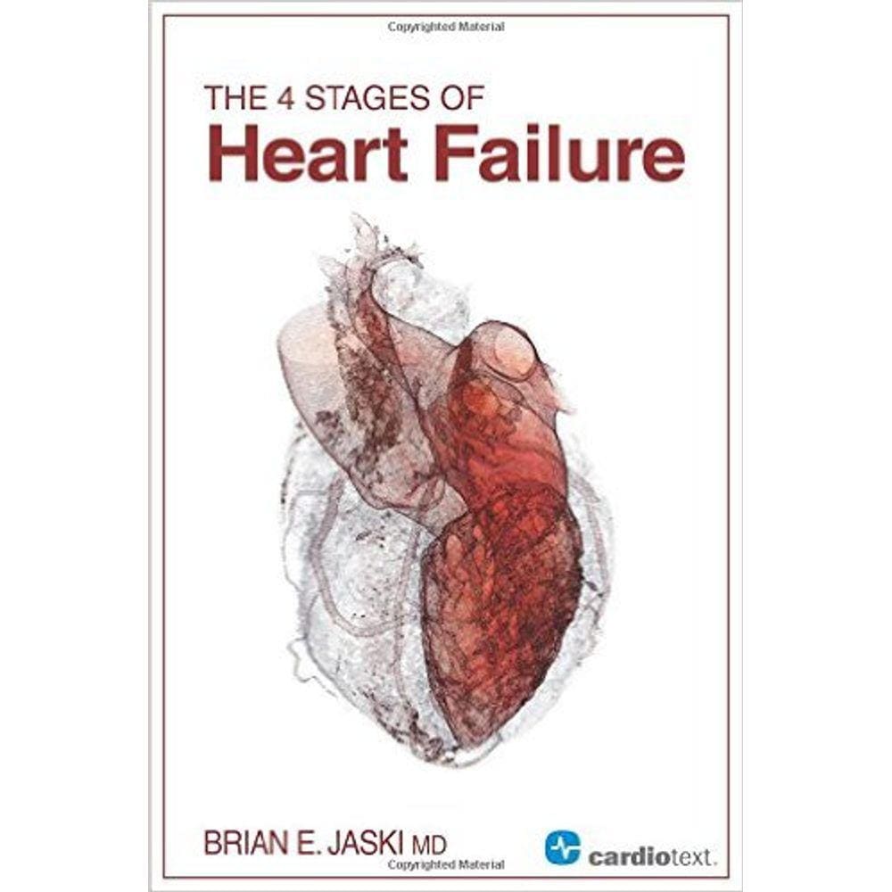The 4 Stages Of Heart Failure