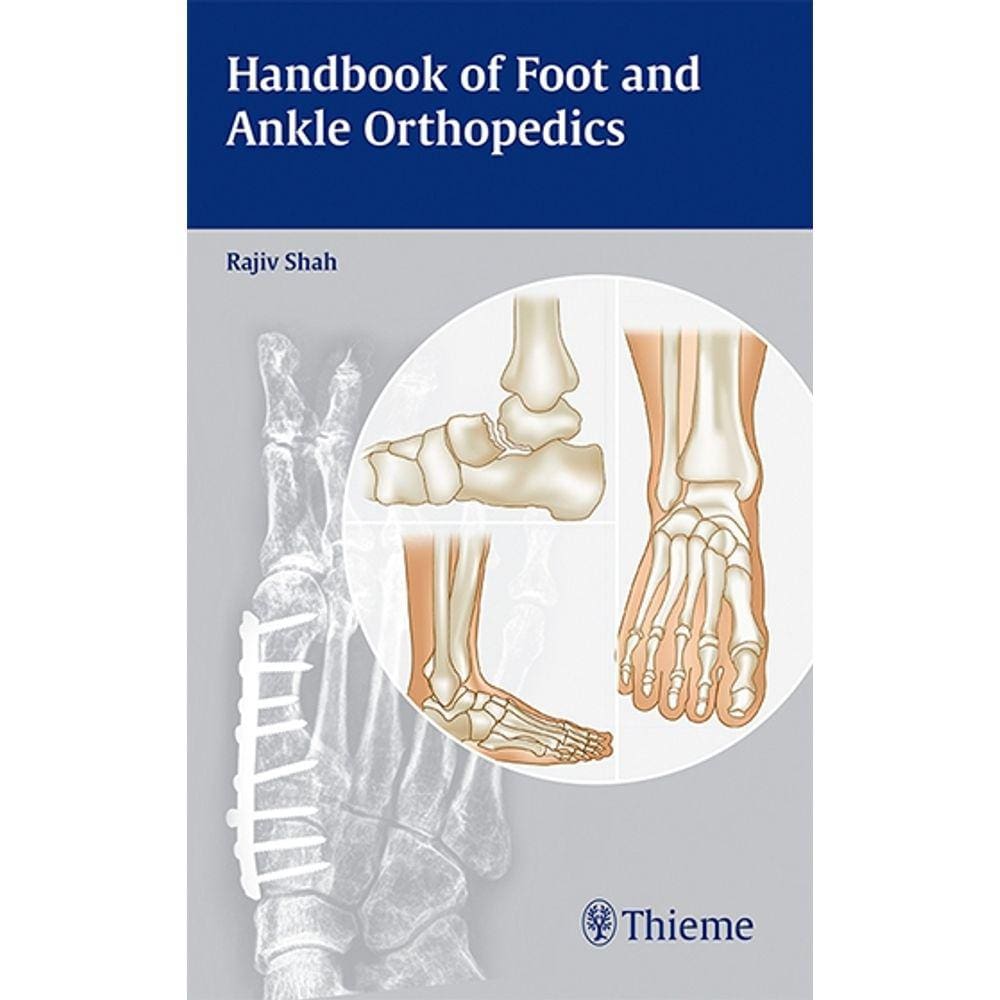 Handbook Of Foot And Ankle Orthopedics