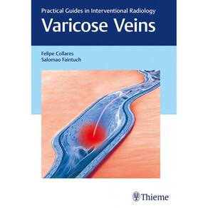 Varicose Veins: Practical Guides In Interventional Radiology