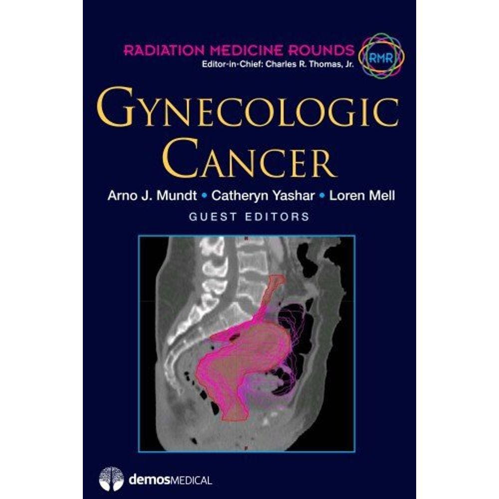 Gynecologic Cancer