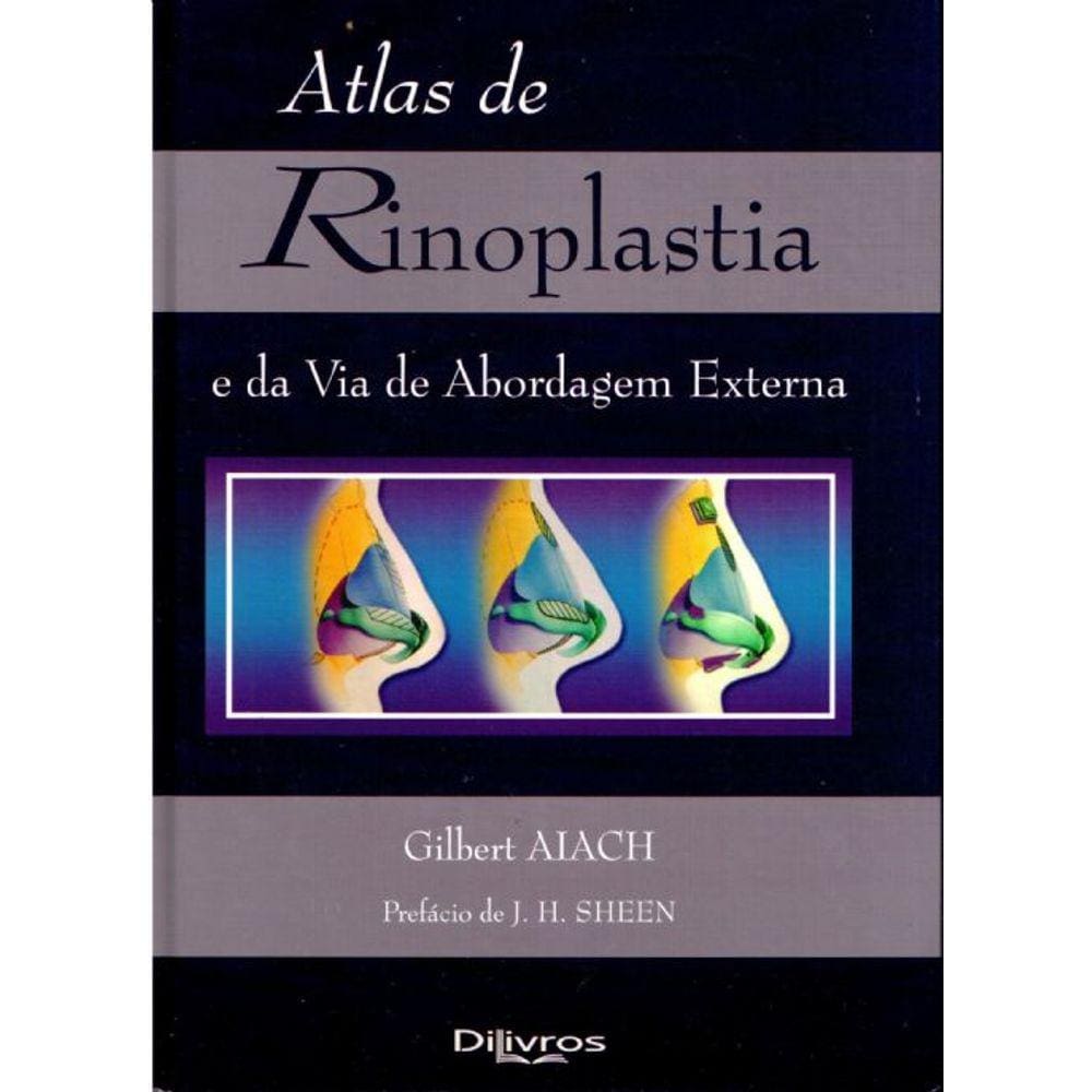 Atlas de Rinoplastia e da Via de Abordagem Externa