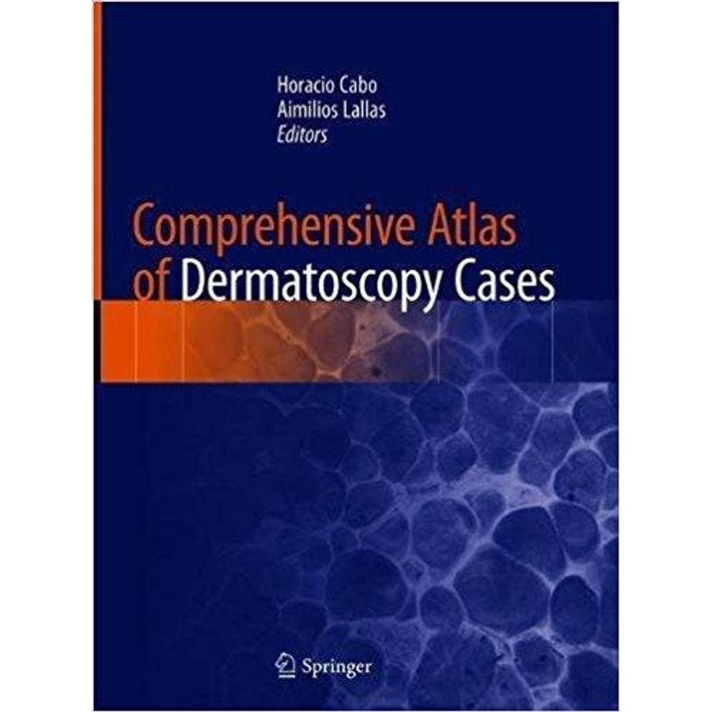 Comprehensive Atlas Of Dermatoscopy Cases