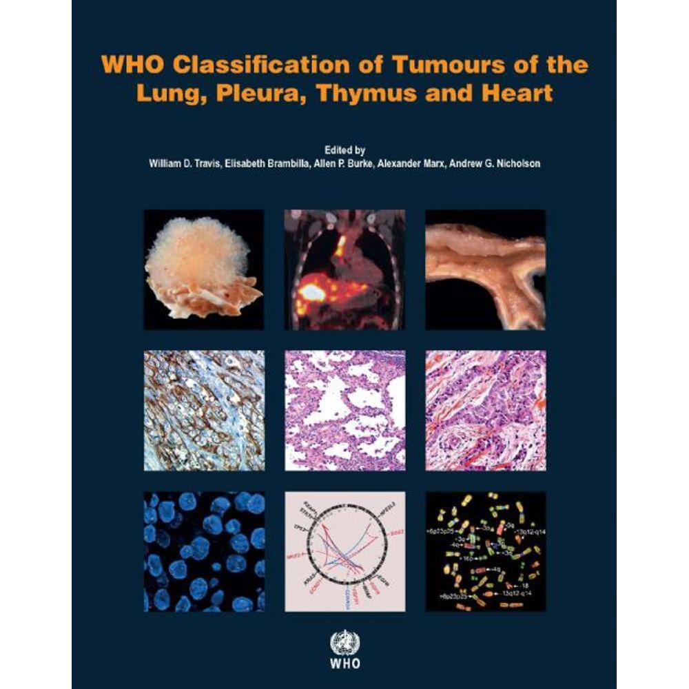 Soft Tissue And Bone Tumours Who Classification Of Tumours Medicine By soft-tissue-and-bone-tumours-who-classification-of-tumours-medicine-by