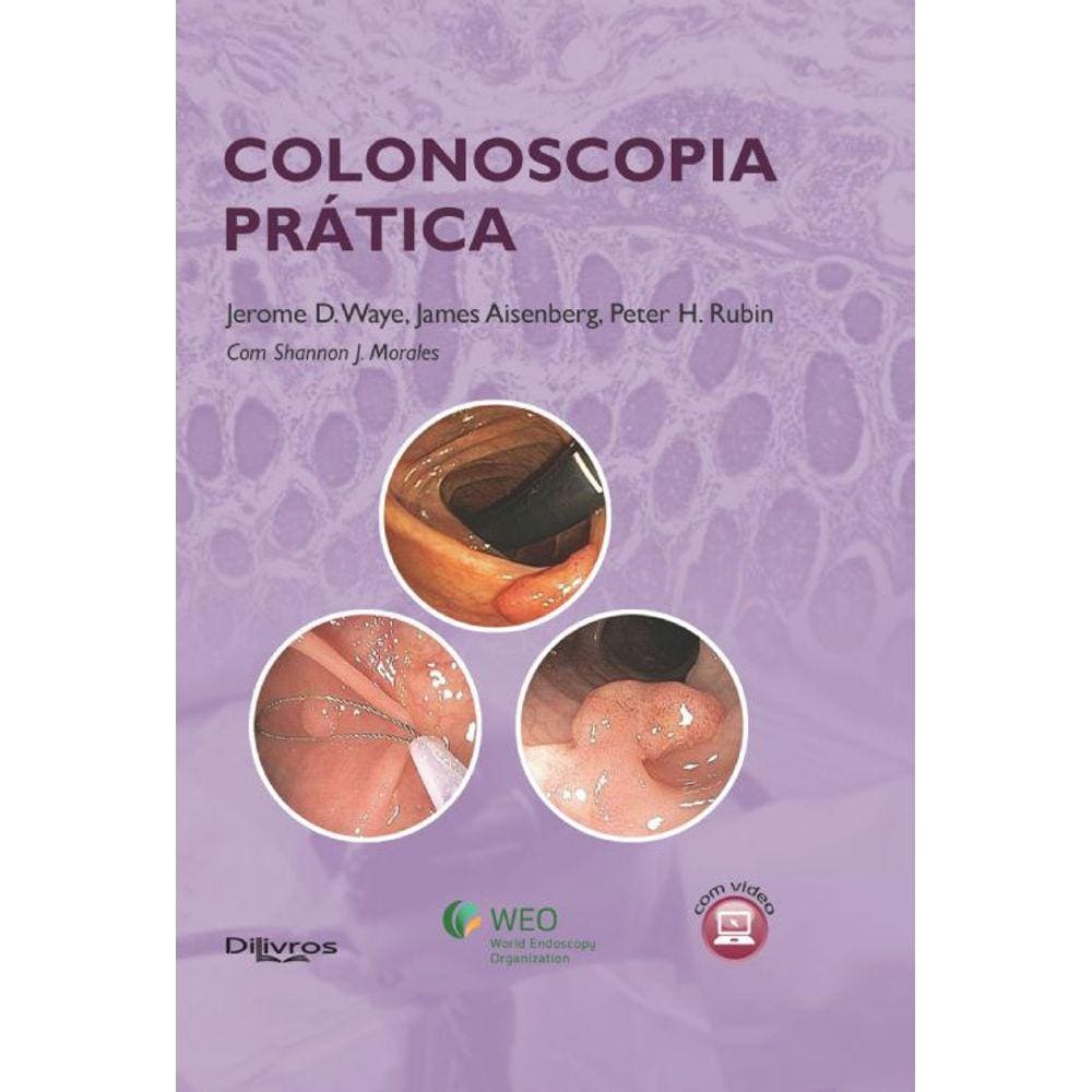 Colonoscopia Pratica