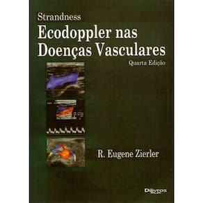 Strandness Ecodoppler Nas Doencas Vasculares