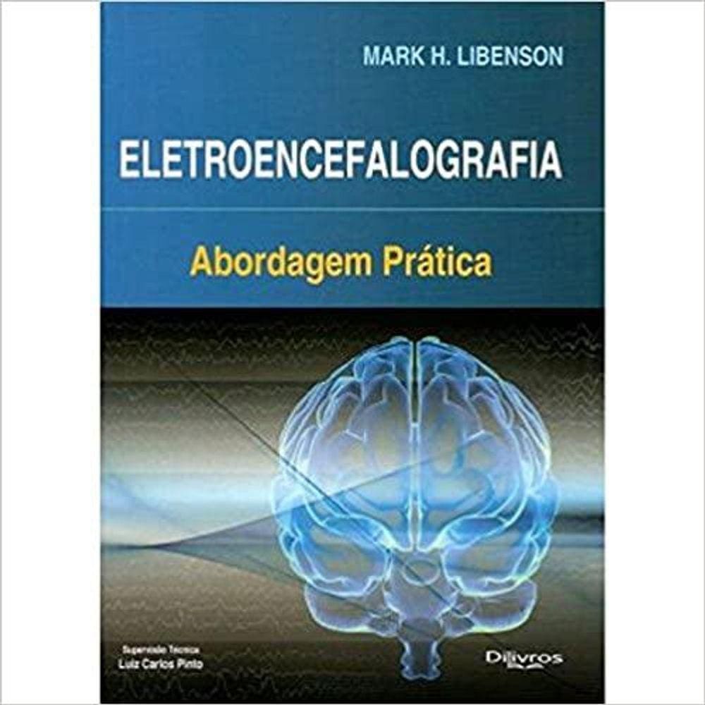 Eletroencefalografia Abordagem Pratica