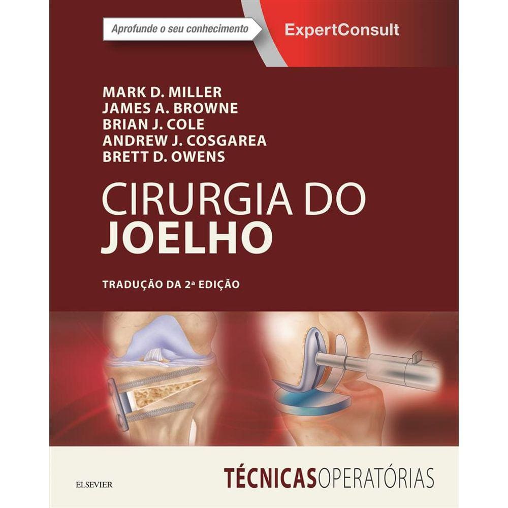 Cirurgia Do Joelho