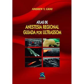 Atlas De Anestesia Regional Guiada Por Ultrason