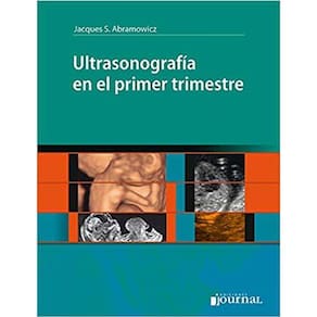 Ultrasonografia En El Primer Trimestre (Espanhol)