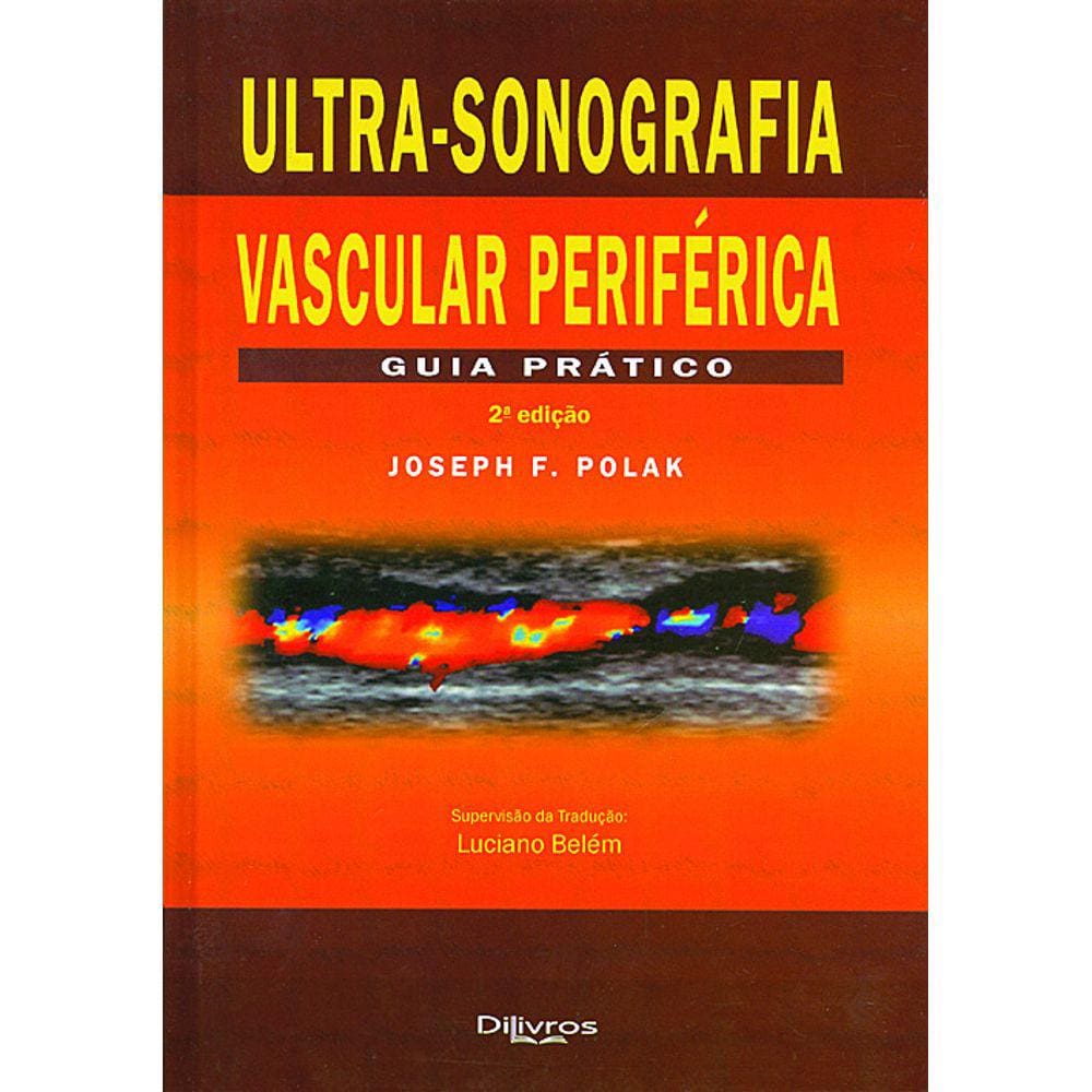 Ultra Sonografia Vascular Periferica Guia Pratico | Casas Bahia