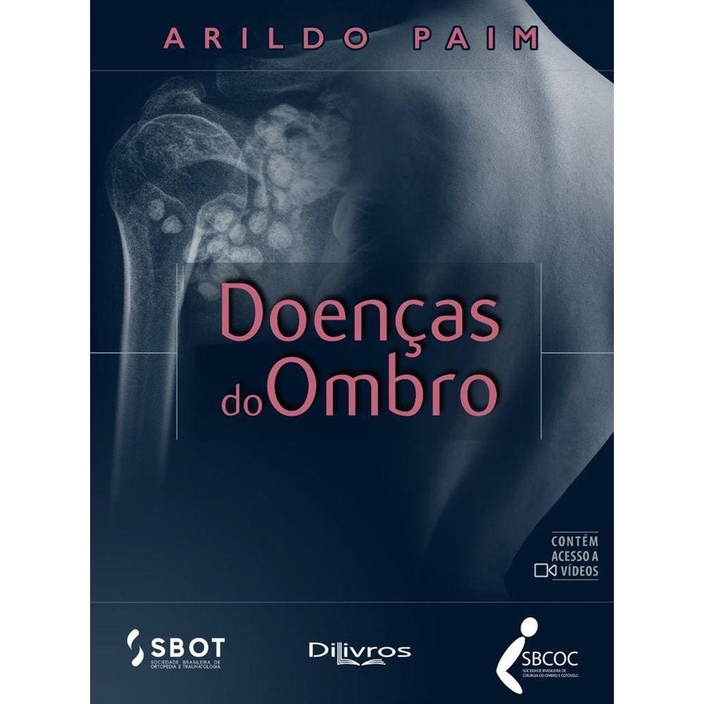 Doencas Do Ombro