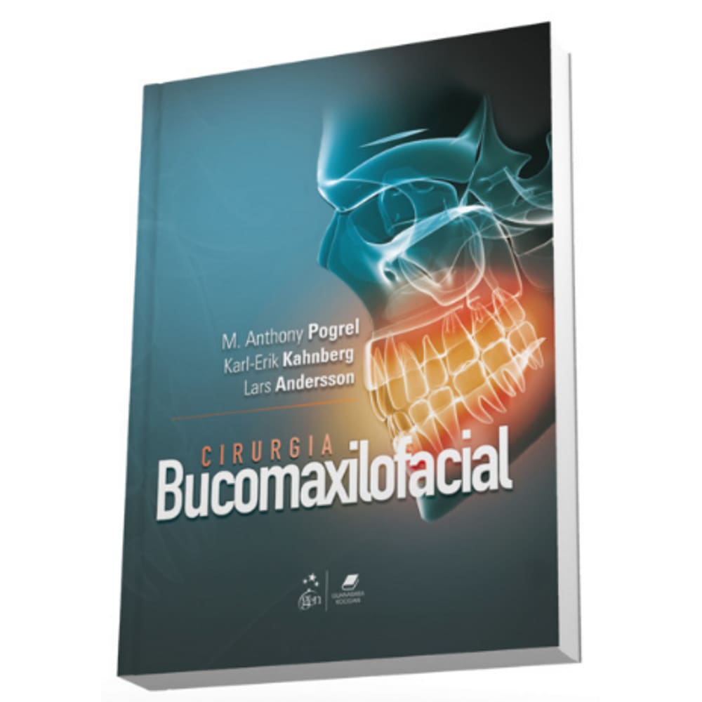 Cirurgia Bucomaxilofacial