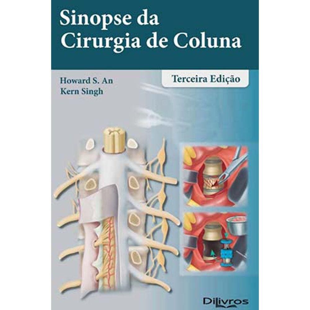 Sinopse Da Cirurgia De Coluna